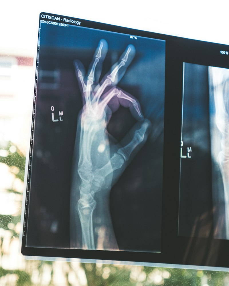 Orthopedics & Joint Care Global Hospital Ayodhya